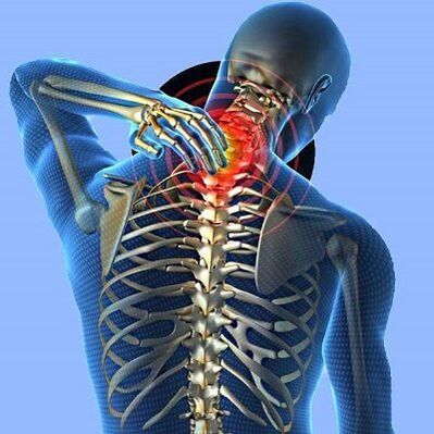 Dor no pescozo con osteocondrose cervical