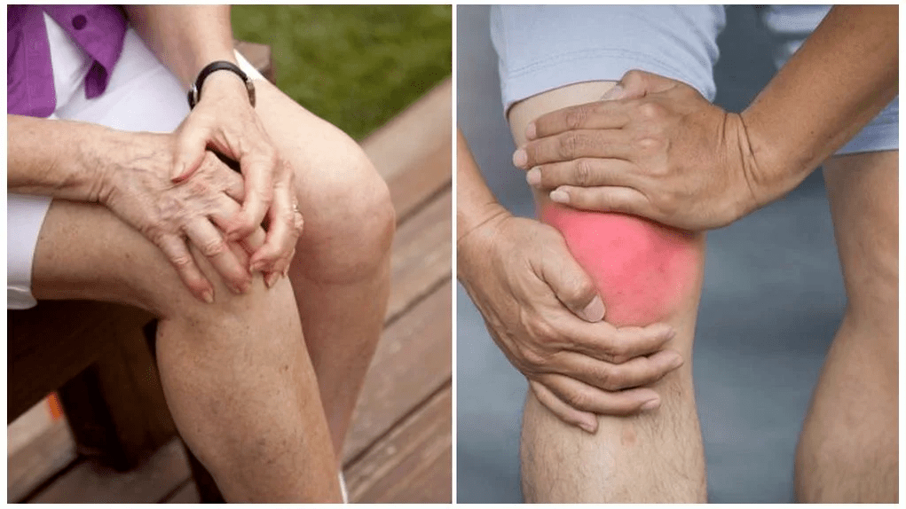 Tratamento da osteoartrite